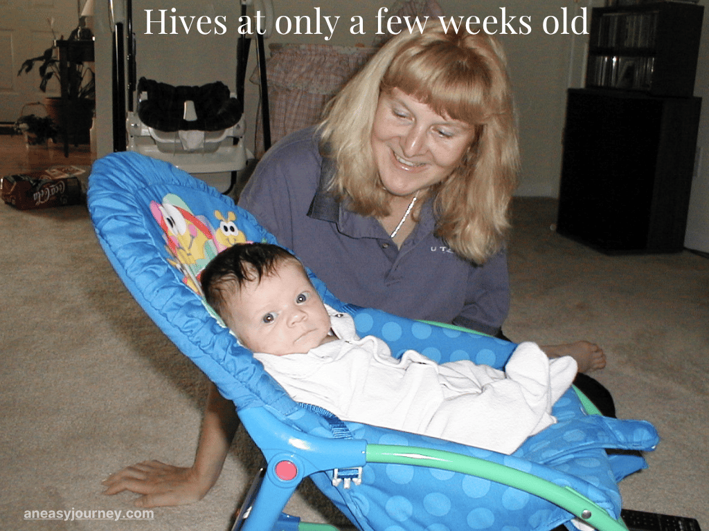 Only a few weeks old, my baby daughter was already having food allergy reactions.